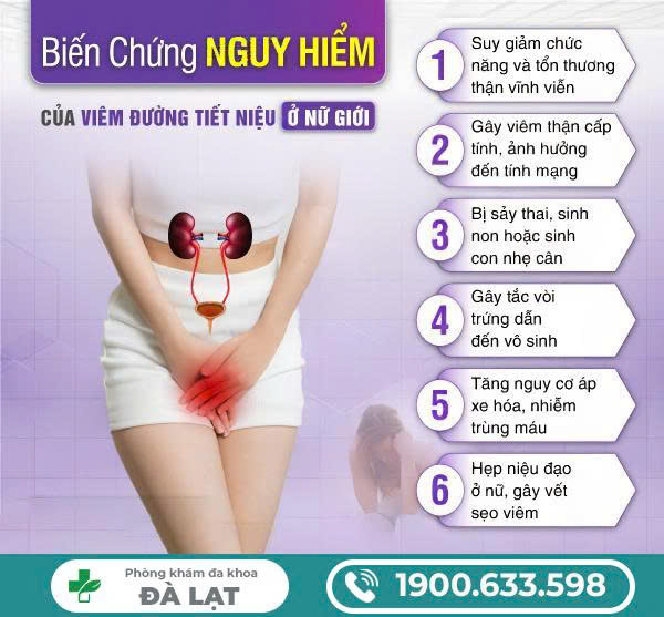 Hình ảnh minh họa